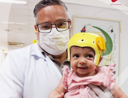 Você sabe para que serve a órtese craniana?