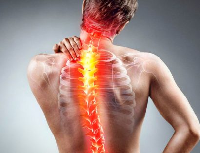 Quais são os tipos de tratamento para escoliose?