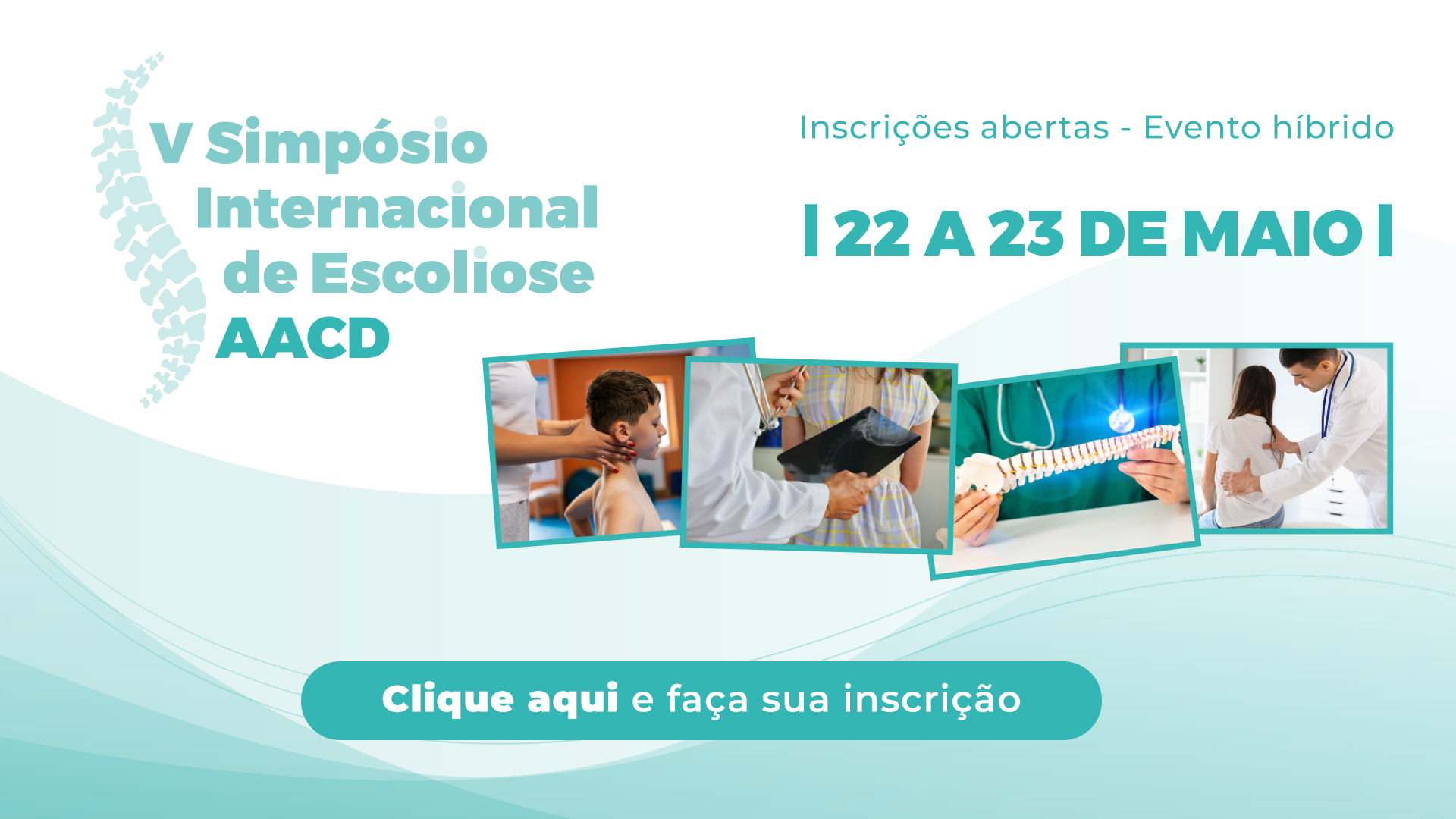AACD abre inscrições com desconto do 1º lote para participar do V Simpósio Internacional de Escoliose. O evento é um dos maiores encontros de especialistas no tema.